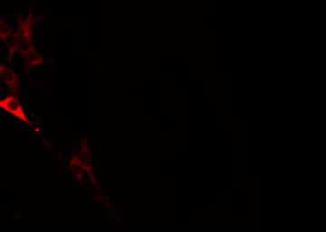 DSG2 / Desmoglein 2 Antibody - Staining HeLa cells by IF/ICC. The samples were fixed with PFA and permeabilized in 0.1% Triton X-100, then blocked in 10% serum for 45 min at 25°C. The primary antibody was diluted at 1:200 and incubated with the sample for 1 hour at 37°C. An Alexa Fluor 594 conjugated goat anti-rabbit IgG (H+L) Ab, diluted at 1/600, was used as the secondary antibody.