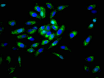 DSG3 / Desmoglein 3 Antibody - Immunofluorescence staining of Hela cells with DSG3 Antibody at 1:166, counter-stained with DAPI. The cells were fixed in 4% formaldehyde, permeabilized using 0.2% Triton X-100 and blocked in 10% normal Goat Serum. The cells were then incubated with the antibody overnight at 4°C. The secondary antibody was Alexa Fluor 488-congugated AffiniPure Goat Anti-Rabbit IgG(H+L).
