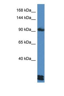 DSG3 / Desmoglein 3 Antibody - DSG3 antibody western blot of HepG2 Cell lysate. Antibody concentration 1 ug/ml.  This image was taken for the unconjugated form of this product. Other forms have not been tested.