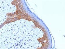 DSG3 / Desmoglein 3 Antibody - IHC testing of FFPE human skin with Desmoglein 3 antibody (clone 5G11). Required HIER: boil tissue sections in 10mM citrate buffer, pH 6, for 10-20 min.