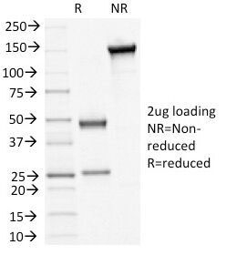 DSG3 / Desmoglein 3 Antibody - SDS-PAGE Analysis of Purified, BSA-Free Desmoglein 3 Antibody (clone 5H10). Confirmation of Integrity and Purity of the Antibody.