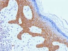 DSG3 / Desmoglein 3 Antibody - IHC testing of FFPE human skin with Desmoglein 3 antibody (clone DSG3/1535). Required HIER: boil tissue sections in 10mM citrate buffer, pH 6, for 10-20 min.