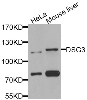 DSG3 / Desmoglein 3 Antibody - Western blot analysis of extracts of various cells.