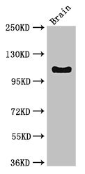 DSG3 / Desmoglein 3 Antibody - Western Blot Positive WB detected in:Mouse brain tissue All Lanes:DSG3 antibody at 3µg/ml Secondary Goat polyclonal to rabbit IgG at 1/50000 dilution Predicted band size: 108 kDa Observed band size: 108 kDa