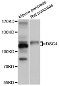 DSG4 / Desmoglein 4 Antibody - Western blot analysis of extracts of various cell lines, using DSG4 antibody at 1:1000 dilution. The secondary antibody used was an HRP Goat Anti-Rabbit IgG (H+L) at 1:10000 dilution. Lysates were loaded 25ug per lane and 3% nonfat dry milk in TBST was used for blocking. An ECL Kit was used for detection and the exposure time was 1s.