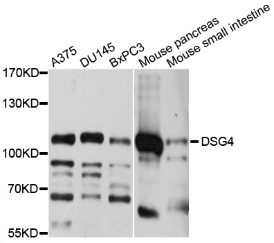DSG4 / Desmoglein 4 Antibody - Western blot analysis of extracts of various cell lines, using DSG4 antibodyat 1:1000 dilution. The secondary antibody used was an HRP Goat Anti-Rabbit IgG (H+L) at 1:10000 dilution. Lysates were loaded 25ug per lane and 3% nonfat dry milk in TBST was used for blocking. An ECL Kit was used for detection and the exposure time was 1s.