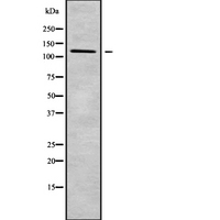 DSG4 / Desmoglein 4 Antibody - Western blot analysis of DSG4 using HeLa whole cells lysates