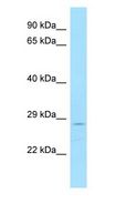 DSN1 Antibody - DSN1 antibody Western Blot of MCF7.  This image was taken for the unconjugated form of this product. Other forms have not been tested.