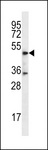 DSN1 Antibody - DSN1 Antibody western blot of MDA-MB231 cell line lysates (35 ug/lane). The DSN1 antibody detected the DSN1 protein (arrow).