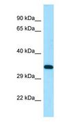 DSN1 Antibody - DSN1 antibody Western Blot of HepG2.  This image was taken for the unconjugated form of this product. Other forms have not been tested.