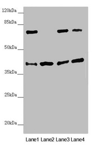 DSN1 Antibody - Western blot All Lanes:DSN1 antibody at 2.19 ug/ml Lane 1: Hela whole cell lysate Lane 2: Mouse skeletal muscle tissue Lane 3: Mouse lung tissue Lane 4: Mouse stomach tissue Secondary Goat polyclonal to rabbit IgG at 1/10000 dilution Predicted band size: 41,33,39,28 kDa Observed band size: 40,70 kDa