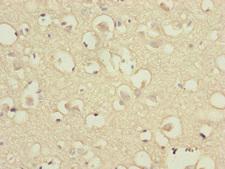DSN1 Antibody - Immunohistochemistry of paraffin-embedded human brain tissue at dilution of 1:100
