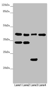 DSN1 Antibody - Western blot All Lanes:DSN1 antibody at 3.09 ug/ml Lane 1: Hela whole cell lysate Lane 2: MCF7 whole cell lysate Lane 3: Mouse lung tissue Lane 4: Mouse gonadal tissue Secondary Goat polyclonal to rabbit IgG at 1/10000 dilution Predicted band size: 41,33,39,28 kDa Observed band size: 40,34,23 kDa