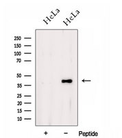 DSN1 Antibody - Western blot analysis of extracts of HeLa cells using DSN1 antibody. The lane on the left was treated with blocking peptide.