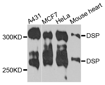 DSP / Desmoplakin Antibody - Western blot analysis of extracts of various cells.