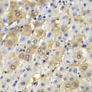 DSP / Desmoplakin Antibody - Immunohistochemistry of paraffin-embedded human liver injury tissue.