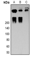 DSP / Desmoplakin Antibody - Western blot analysis of Desmoplakin expression in MCF7 (A); HeLa (B); mouse heart (C) whole cell lysates.