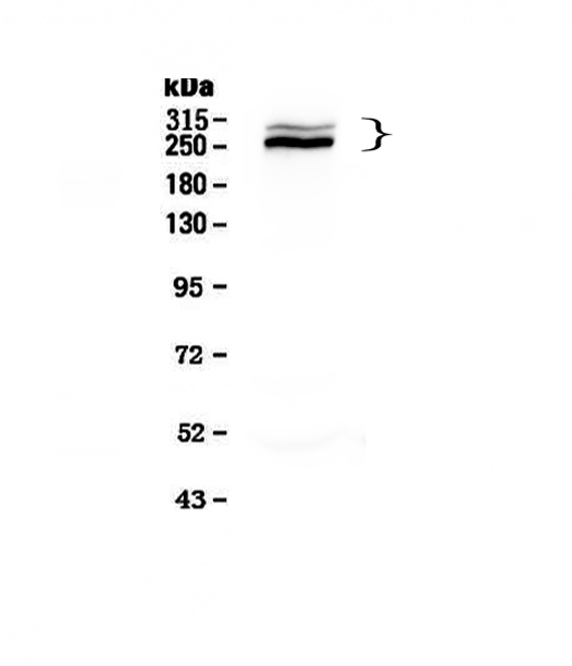 DSP / Desmoplakin Antibody - Western blot - Anti-Desmoplakin Picoband antibody