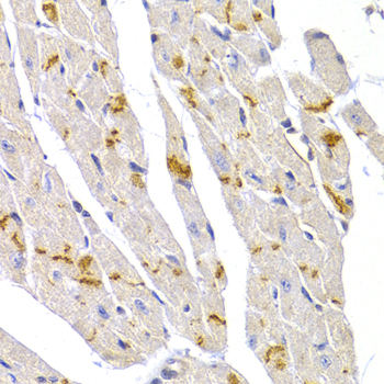 DSP / Desmoplakin Antibody - Immunohistochemistry of paraffin-embedded mouse heart using DSP antibody at dilution of 1:100 (40x lens).