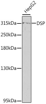 DSP / Desmoplakin Antibody - Western blot analysis of extracts of HepG2 cells, using DSP antibody at 1:800 dilution. The secondary antibody used was an HRP Goat Anti-Rabbit IgG (H+L) at 1:10000 dilution. Lysates were loaded 25ug per lane and 3% nonfat dry milk in TBST was used for blocking. An ECL Kit was used for detection and the exposure time was 60s.