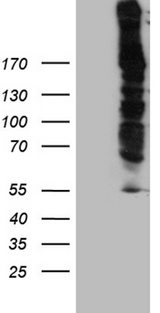 DSP / Desmoplakin Antibody - HEK293T cells were transfected with the pCMV6-ENTRY control. (Left lane) or pCMV6-ENTRY DSP. (Right lane) cDNA for 48 hrs and lysed. Equivalent amounts of cell lysates. (5 ug per lane) were separated by SDS-PAGE and immunoblotted with anti-DSP rabbit polyclonal antibody.