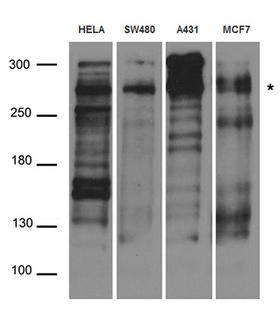 DSP / Desmoplakin Antibody - Western blot analysis of extracts. (35ug) from different cell lines and tissues by using anti-DSP rabbit polyclonal antibody.