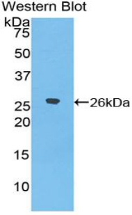DSPG3 / Epiphycan Antibody - Western blot of recombinant DSPG3 / Epiphycan.  This image was taken for the unconjugated form of this product. Other forms have not been tested.