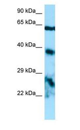 DSPG3 / Epiphycan Antibody - DSPG3 / Epiphycan antibody Western Blot of HepG2.  This image was taken for the unconjugated form of this product. Other forms have not been tested.