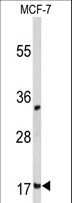 DSTN / Destrin Antibody - Western blot of DSTN Antibody in MCF-7 cell line lysates (35 ug/lane). DSTN (arrow) was detected using the purified antibody.