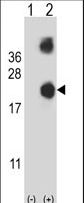 DSTN / Destrin Antibody - Western blot of DSTN (arrow) using rabbit polyclonal DSTN Antibody. 293 cell lysates (2 ug/lane) either nontransfected (Lane 1) or transiently transfected (Lane 2) with the DSTN gene.