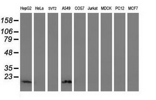 DSTN / Destrin Antibody - Western blot of extracts (35ug) from 9 different cell lines by using anti-DSTN monoclonal antibody.
