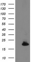 DSTN / Destrin Antibody - HEK293T cells were transfected with the pCMV6-ENTRY control (Left lane) or pCMV6-ENTRY DSTN (Right lane) cDNA for 48 hrs and lysed. Equivalent amounts of cell lysates (5 ug per lane) were separated by SDS-PAGE and immunoblotted with anti-DSTN.