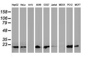 DSTN / Destrin Antibody - Western blot of extracts (35ug) from 9 different cell lines by using anti-DSTN monoclonal antibody.