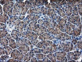 DSTN / Destrin Antibody - IHC of paraffin-embedded Human pancreas tissue using anti-DSTN mouse monoclonal antibody. (Heat-induced epitope retrieval by 10mM citric buffer, pH6.0, 100C for 10min).