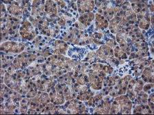 DSTN / Destrin Antibody - IHC of paraffin-embedded Human pancreas tissue using anti-DSTN mouse monoclonal antibody. (Heat-induced epitope retrieval by 10mM citric buffer, pH6.0, 100C for 10min).
