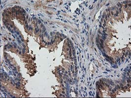 DSTN / Destrin Antibody - IHC of paraffin-embedded Human prostate tissue using anti-DSTN mouse monoclonal antibody. (Heat-induced epitope retrieval by 10mM citric buffer, pH6.0, 100C for 10min).