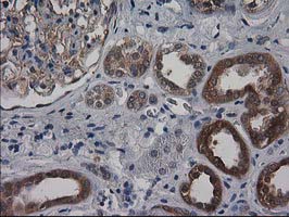 DSTN / Destrin Antibody - IHC of paraffin-embedded Human Kidney tissue using anti-DSTN mouse monoclonal antibody. (Heat-induced epitope retrieval by 10mM citric buffer, pH6.0, 100C for 10min).