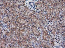 DSTN / Destrin Antibody - IHC of paraffin-embedded Human pancreas tissue using anti-DSTN mouse monoclonal antibody.