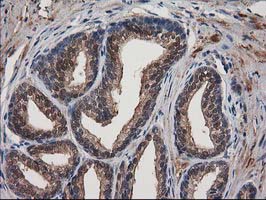 DSTN / Destrin Antibody - IHC of paraffin-embedded Human prostate tissue using anti-DSTN mouse monoclonal antibody.