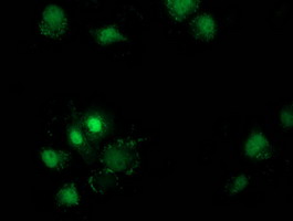 DSTN / Destrin Antibody - Anti-DSTN mouse monoclonal antibody immunofluorescent staining of COS7 cells transiently transfected by pCMV6-ENTRY DSTN.