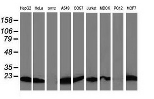 DSTN / Destrin Antibody - Western blot of extracts (35 ug) from 9 different cell lines by using anti-DSTN monoclonal antibody.