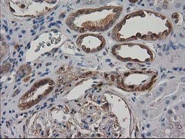 DSTN / Destrin Antibody - IHC of paraffin-embedded Human Kidney tissue using anti-DSTN mouse monoclonal antibody.