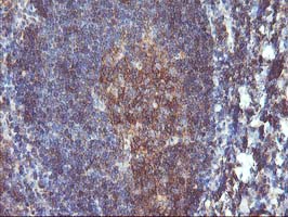 DSTN / Destrin Antibody - IHC of paraffin-embedded Human tonsil using anti-DSTN mouse monoclonal antibody.