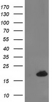 DSTN / Destrin Antibody - HEK293T cells were transfected with the pCMV6-ENTRY control (Left lane) or pCMV6-ENTRY DSTN (Right lane) cDNA for 48 hrs and lysed. Equivalent amounts of cell lysates (5 ug per lane) were separated by SDS-PAGE and immunoblotted with anti-DSTN.