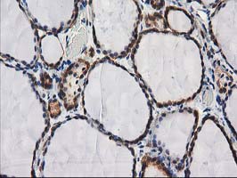 DSTN / Destrin Antibody - IHC of paraffin-embedded Human thyroid tissue using anti-DSTN mouse monoclonal antibody.