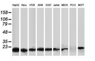 DSTN / Destrin Antibody - Western blot of extracts (35 ug) from 9 different cell lines by using anti-DSTN monoclonal antibody (HepG2: human; HeLa: human; SVT2: mouse; A549: human; COS7: monkey; Jurkat: human; MDCK: canine; PC12: rat; MCF7: human).