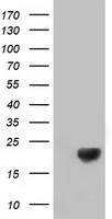 DSTN / Destrin Antibody - HEK293T cells were transfected with the pCMV6-ENTRY control (Left lane) or pCMV6-ENTRY DSTN (Right lane) cDNA for 48 hrs and lysed. Equivalent amounts of cell lysates (5 ug per lane) were separated by SDS-PAGE and immunoblotted with anti-DSTN.