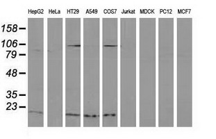 DSTN / Destrin Antibody - Western blot of extracts (35ug) from 9 different cell lines by using anti-DSTN monoclonal antibody (HepG2: human; HeLa: human; SVT2: mouse; A549: human; COS7: monkey; Jurkat: human; MDCK: canine; PC12: rat; MCF7: human).