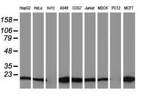 DSTN / Destrin Antibody - Western blot of extracts (35 ug) from 9 different cell lines by using anti-DSTN monoclonal antibody.