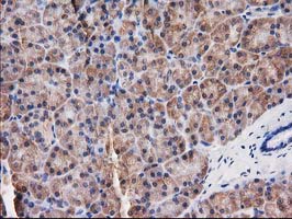 DSTN / Destrin Antibody - IHC of paraffin-embedded Human pancreas tissue using anti-DSTN mouse monoclonal antibody.